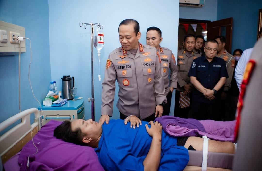 Bentuk Perhatian Pimpinan, Kapolda Metro Jaya Besuk Tiga Polisi yang Cedera Saat Bertugas di RS Bhayangkara